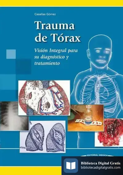 Descargar Trauma De Tórax
