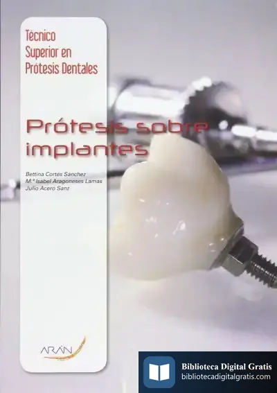 Descargar Prótesis Sobre Implantes de Saki Tsukahara