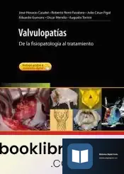Descargar Valvulopatías
