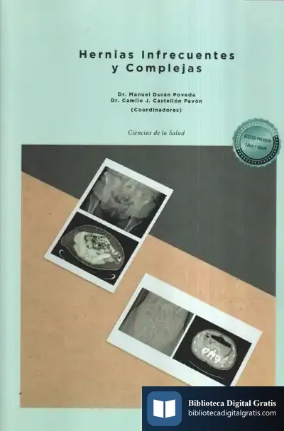 Descargar Hernias Infrecuentes Y Complejas de D. Alías Jiménez