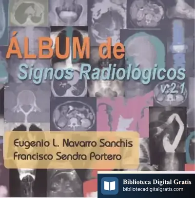 Descargar Álbum De Signos Radiológicos