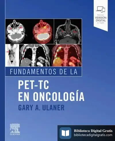 Descargar Fundamentos De La Pet-Tc En Oncología