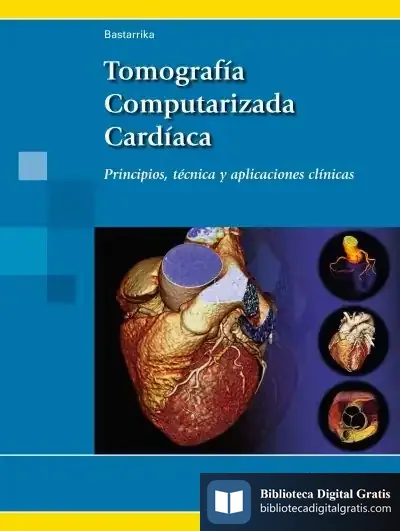 Descargar Tomografía Computarizada Cardíaca de Gorka Bastarrika Alemañ
