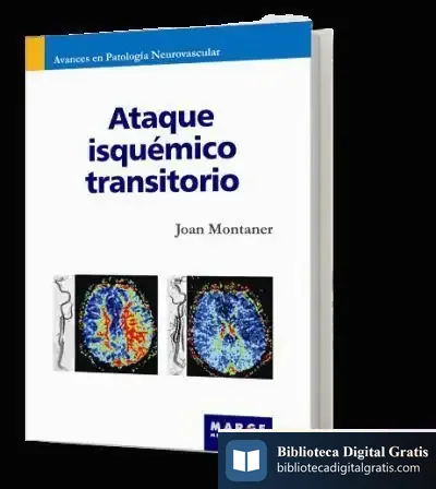 Descargar Ataque Isquémico Transitorio de Joan Montaner Villalonga