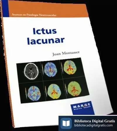 Descargar Ictus Lacunar de Joan Montaner Villalonga
