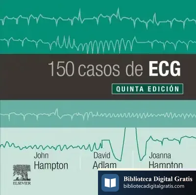 Descargar 150 Casos De Ecg