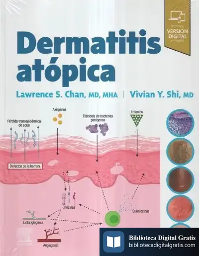 Descargar Dermatitis Atopica de Lawrence S. Chan
