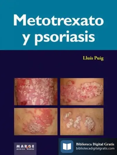 Descargar Metotrexato Y Psoriaris