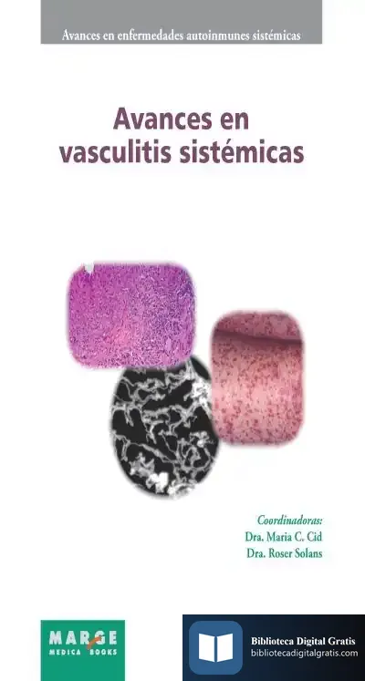 Descargar Avances Vasculitis Sistémicas