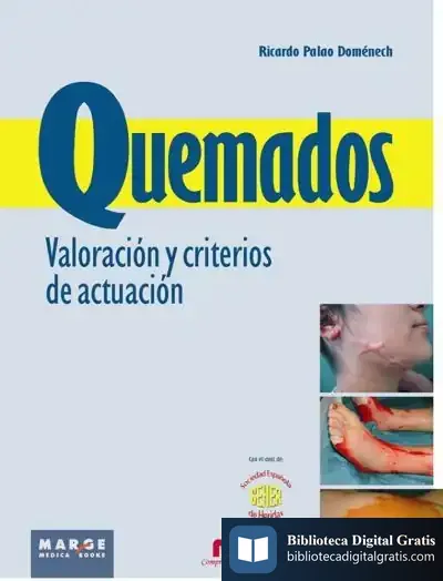 Descargar Quemados. Valoración Y Criterios De Actuación de Benjamin Lacombe